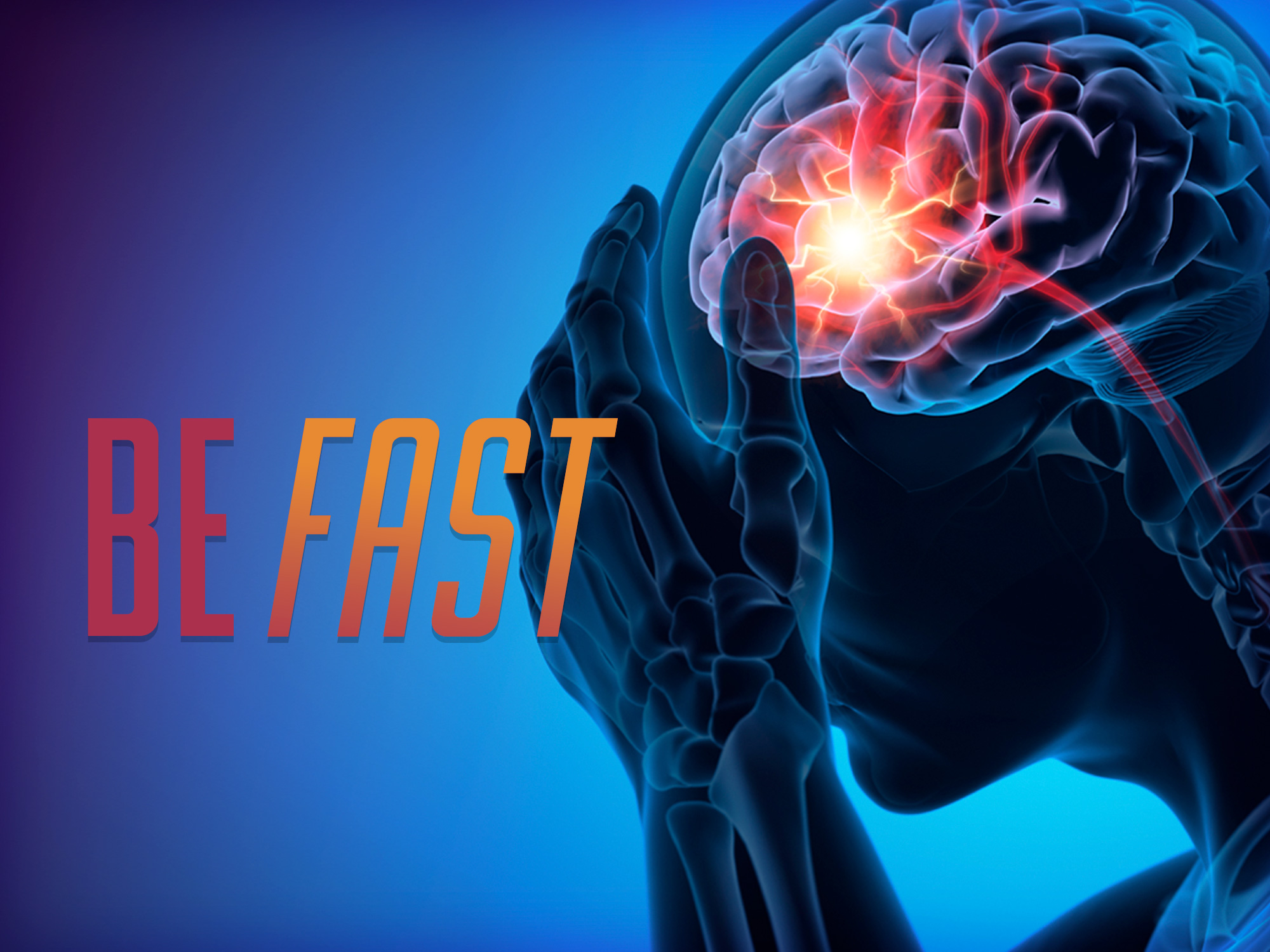 Timely stroke care essential for recovery, UMMC experts say